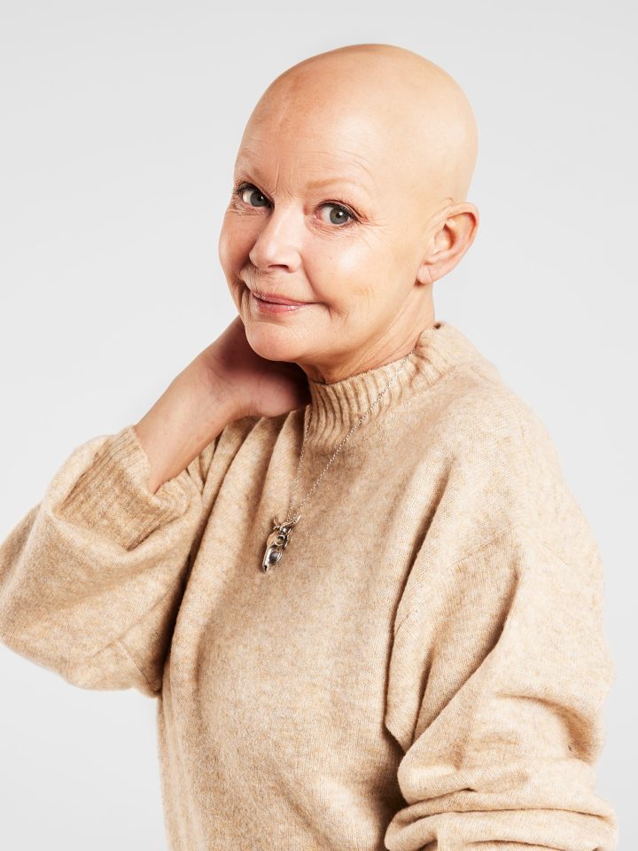 For almost two decades, since alopecia robbed her of her hair overnight, the Scottish star had proudly rocked a bald head