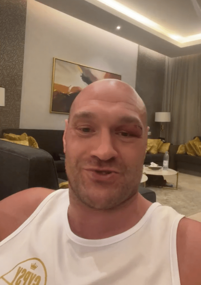 Fury hit back at retirement suggestions and sent a chilling warning to Usyk on Instagram