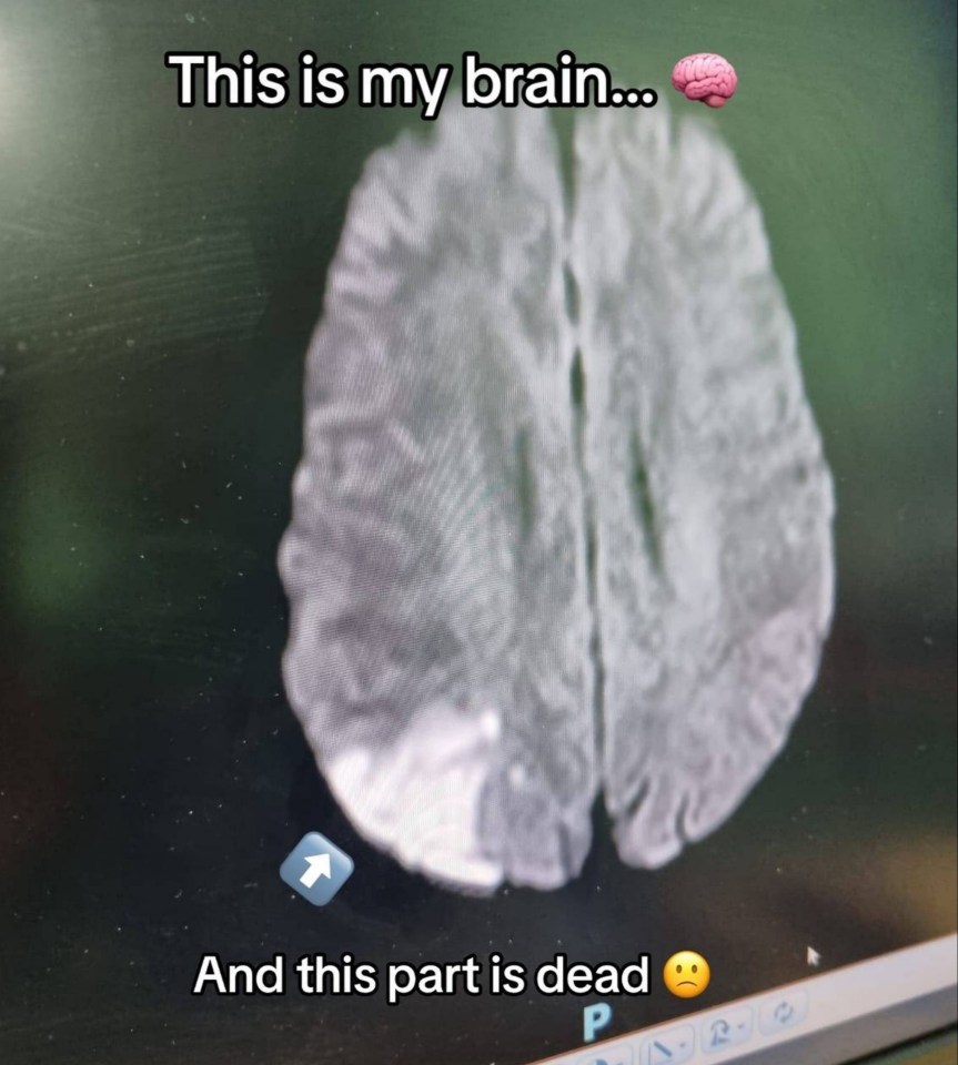 It turned out the dad was having a massive stroke that killed a part of his brain