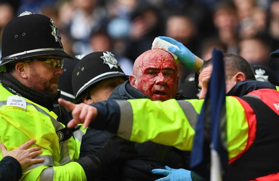 An injured fan is taken away at the West Brom v Wolvs match