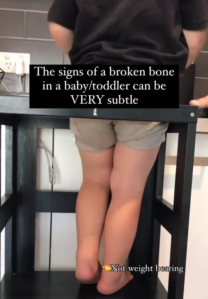 Nikki Jurcutz, of Tiny Hearts Education, has revealed how to spot if your child has a broken bone