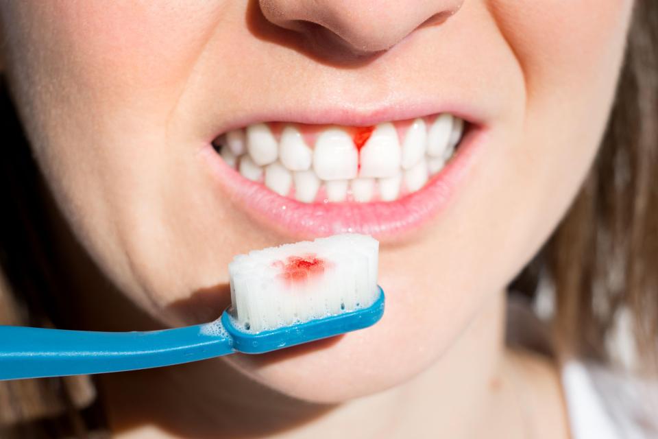 Sore or bleeding gums? Don't delay - see a dentist