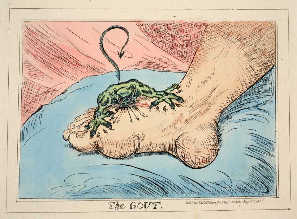 The Gout, pub. 1835 by James Gillray