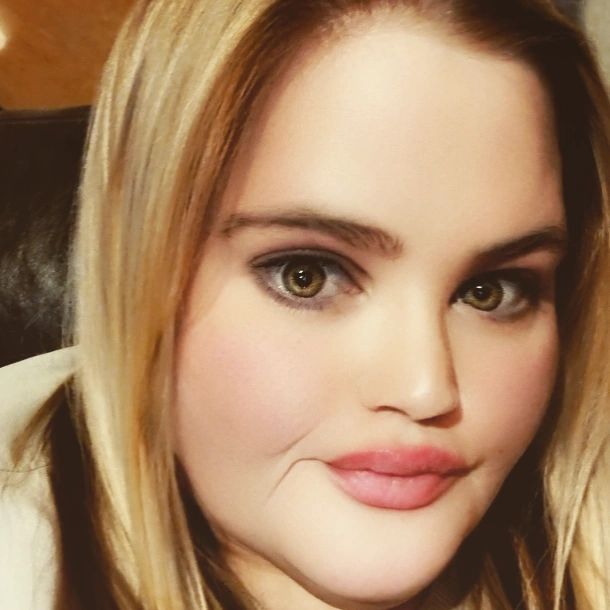 Emma blamed her 'genes' on piling on the pounds in the past