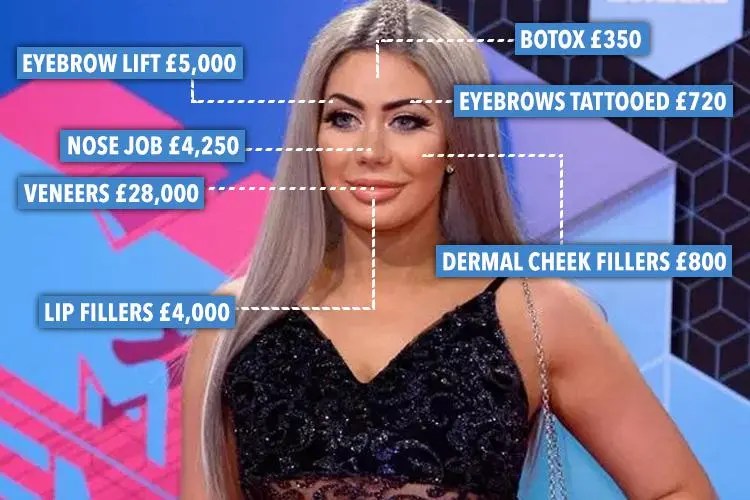 Chloe is believed to have spent £50k on surgery over the years