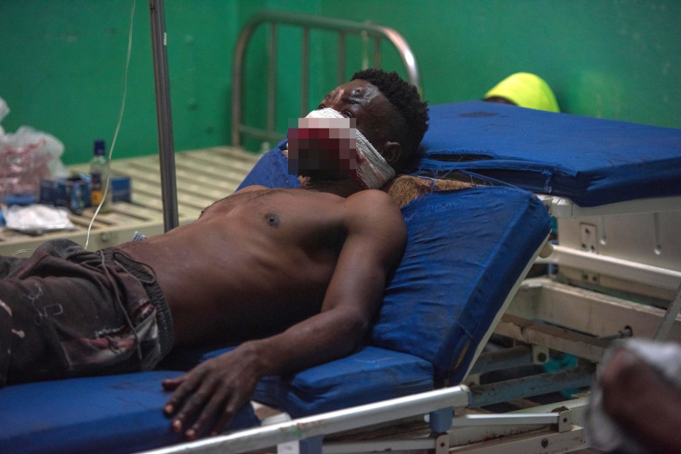 An injured man waiting to be treated at a health centre