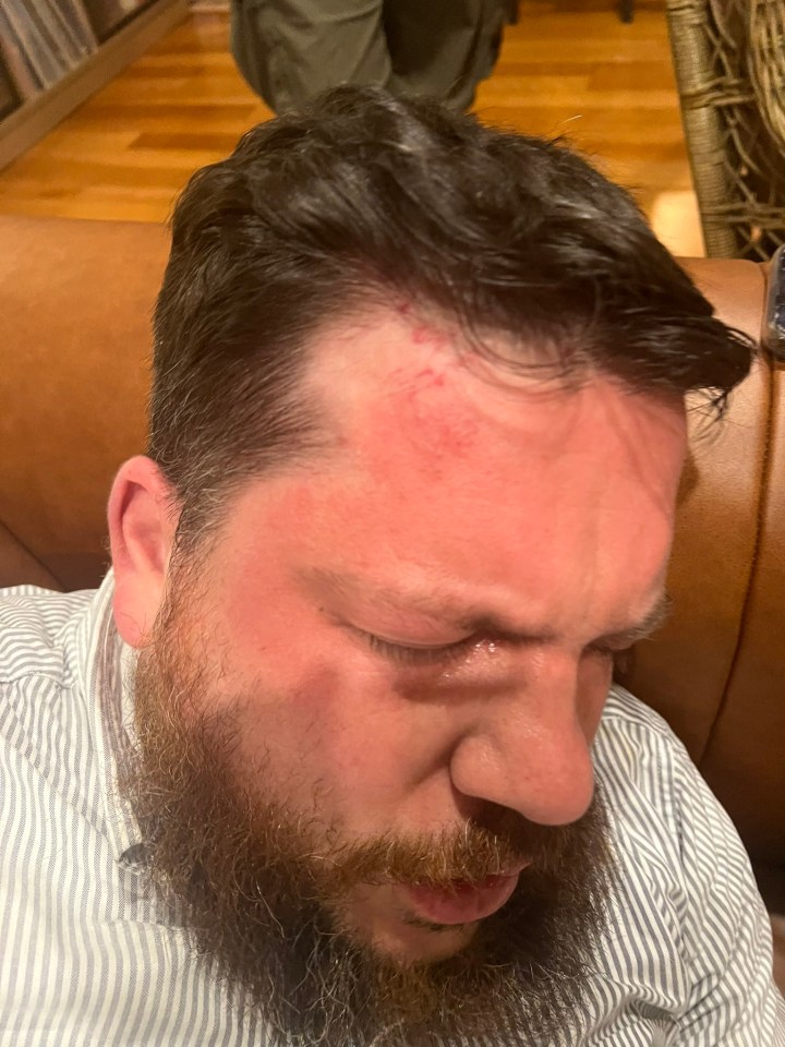 Navalny’s long-time ally Leonid Volkov, pictured, was attacked with a hammer in Lithuania on Tuesday