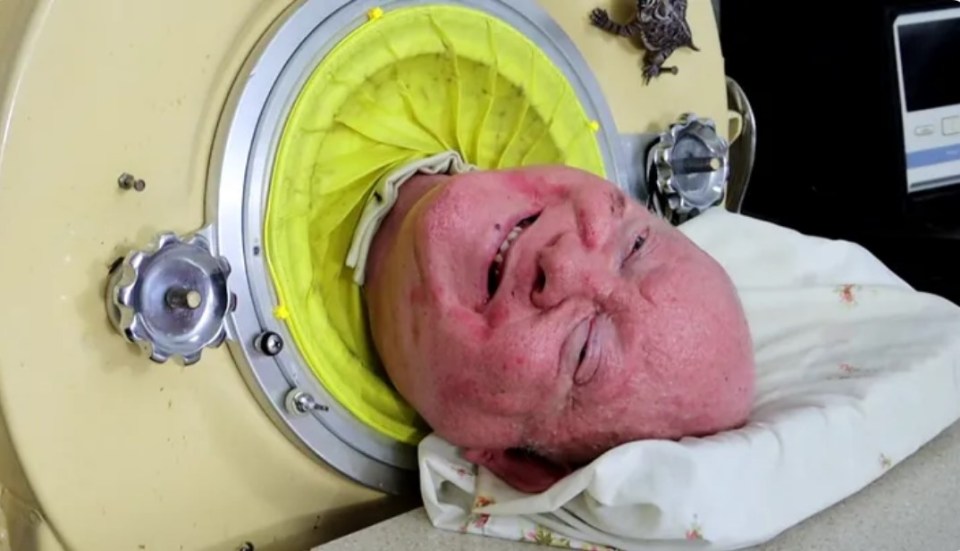 The inspirational Paul Alexander still using the daunting iron lung in 2019