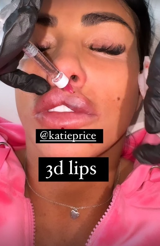 The reality star once again had her lips enlarged