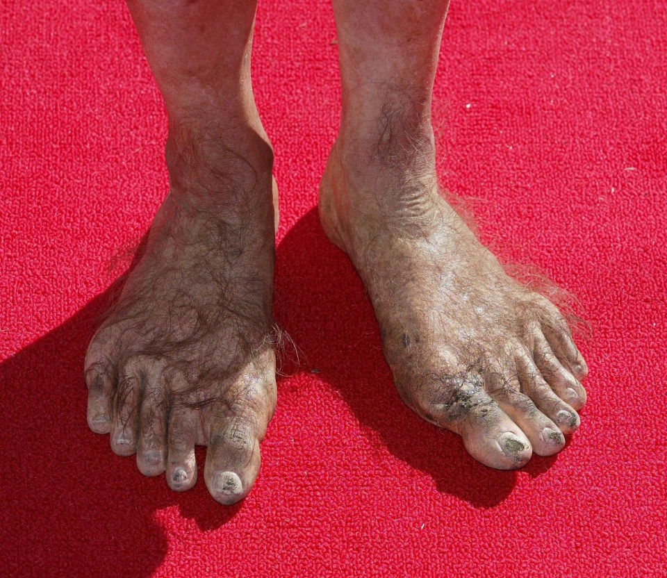 A report claims our feet are much narrower than those of our ancestors