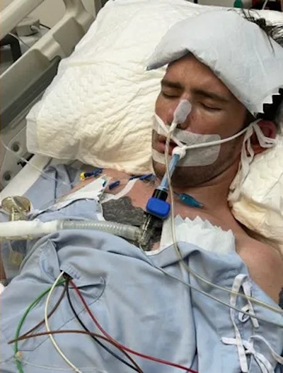 The Brit tourist, 32, is now in a coma fighting for his life