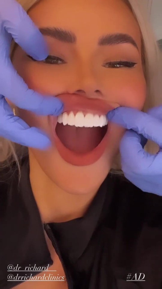 The TOWIE veteran claimed she was mocked for her teeth and has since had many dental makeovers, including veneers