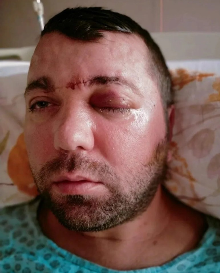 Ramazan Yilmaz in hospital after his botched surgery