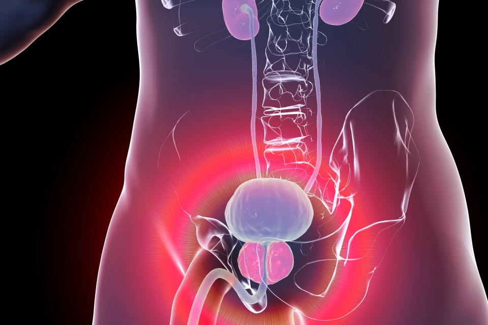 Scientists can spot if a man is likely to have his prostate cancer return from his DNA