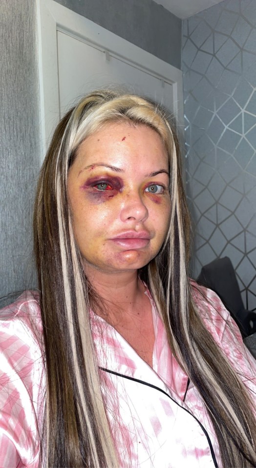 He stamped on her head with such brutality that her eyes appeared to be 'popping out'