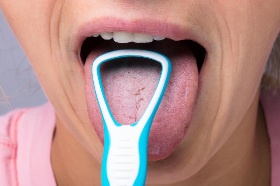 A tongue scraper gets rid of plaque build-up on the tongue