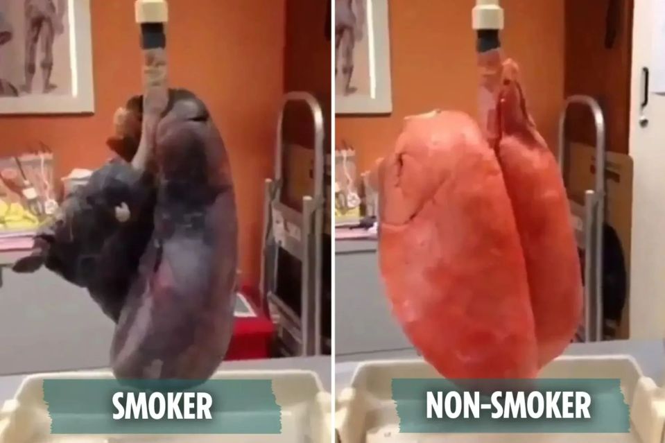 A video shared to Instagram laid bare how radically cigarettes can affect your lung function