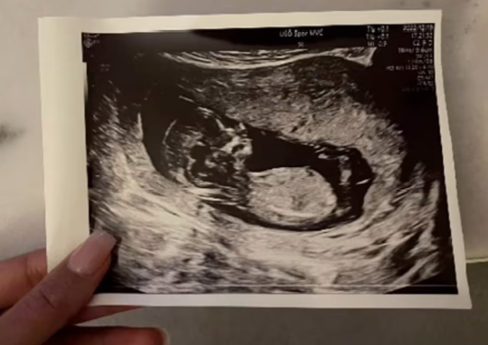 Saga was excited to be a new mother and shared an ultrasound picture with her loved ones