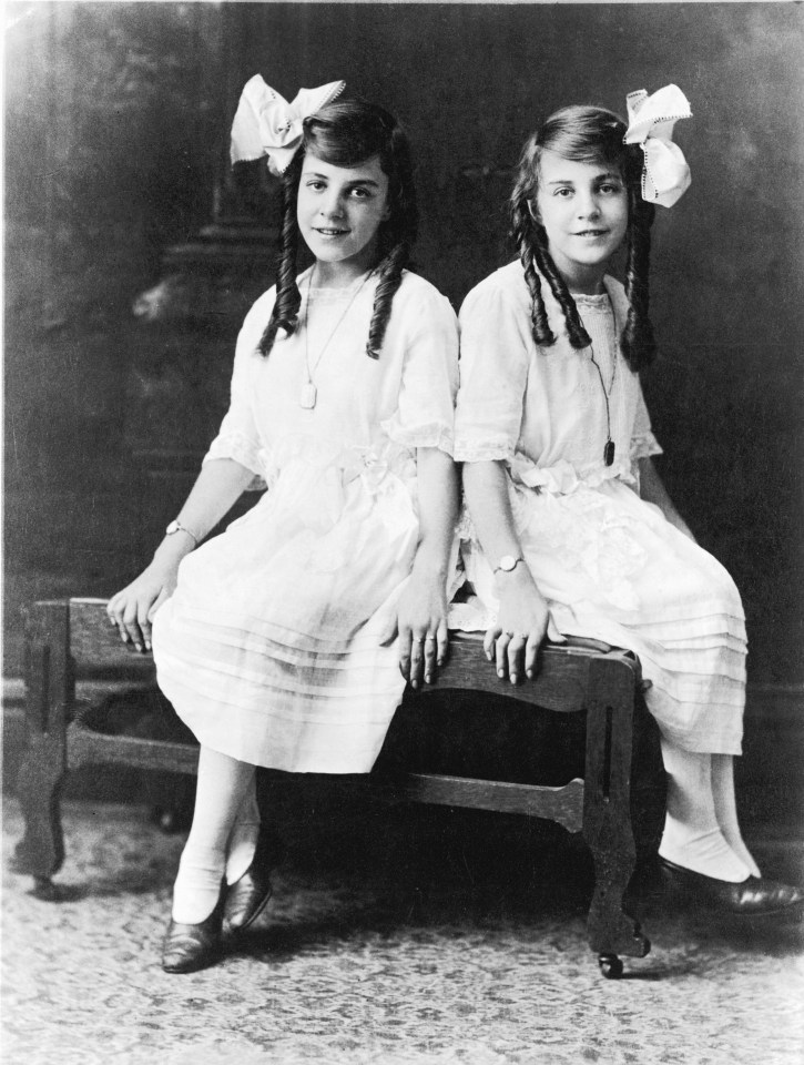 Conjoined twins Violet, left, and Daisy Hilton, right, were born in 1908; they are pictured wearing matching dresses in the early 1920s