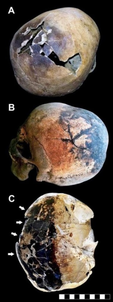 Several of the skeletons' skulls had gaping holes and stains