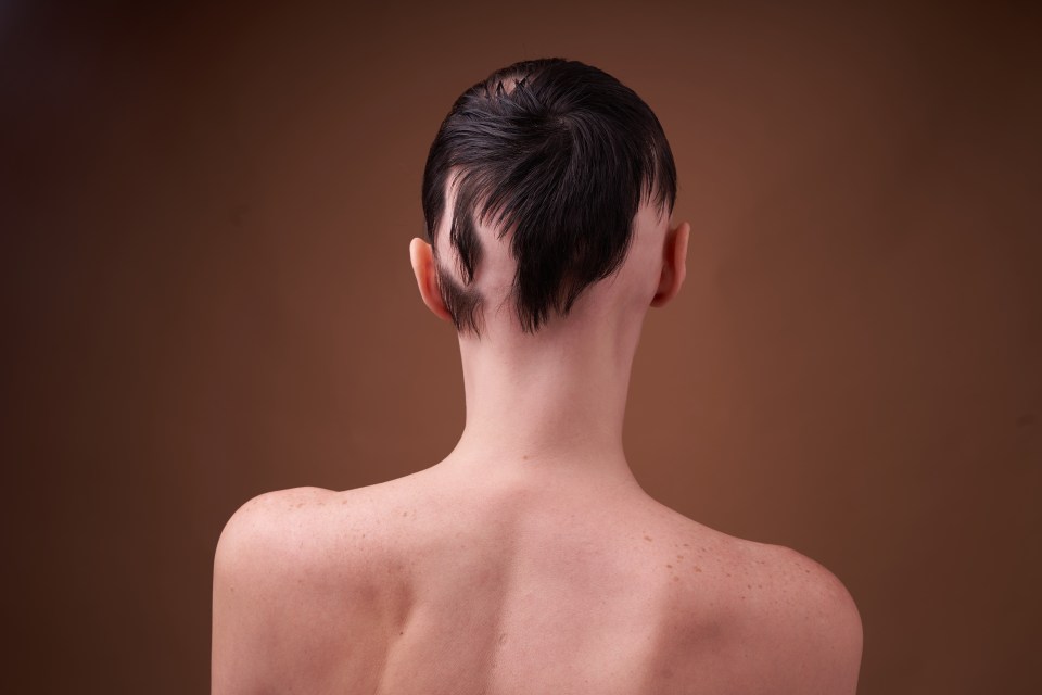 "In some areas, my bald spots are nearly all covered up, which for me is amazing," one shopper beamed