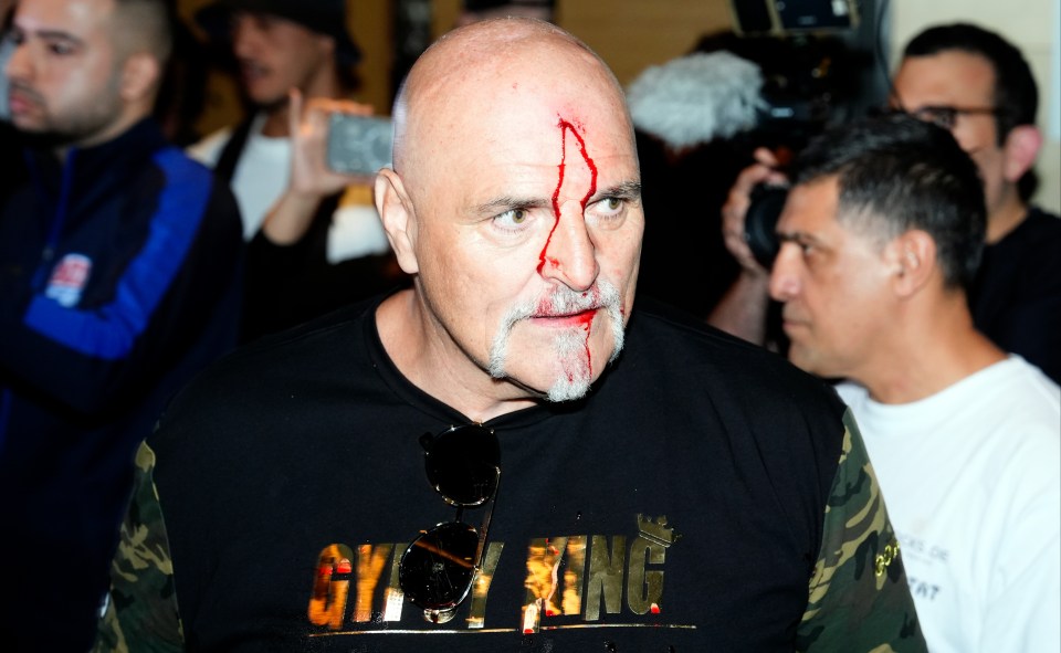 John Fury was left bloodied on Monday after headbutting a member of Oleksandr Usyk's team