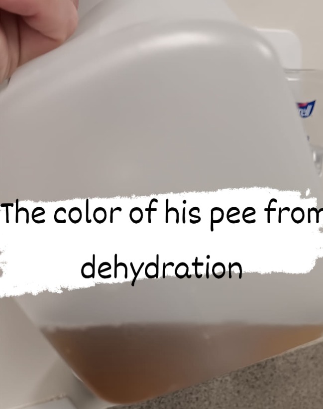 Jake was so dehydrated his urine was 'almost black'