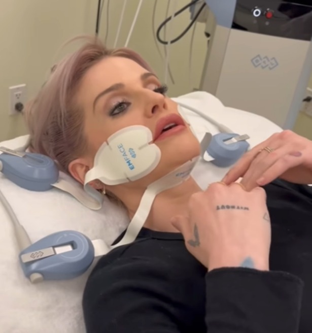 The TV star having EmSculpt treatment, which claims to tighten loose skin