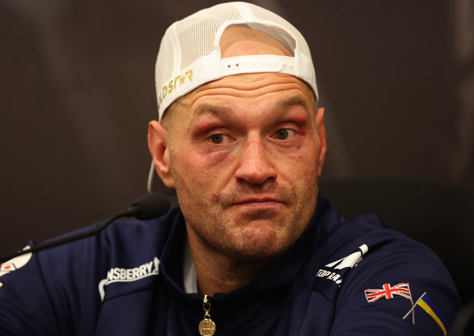 Fury will now look to lick his wounds following the defeat with the Gypsy King looking badly beaten