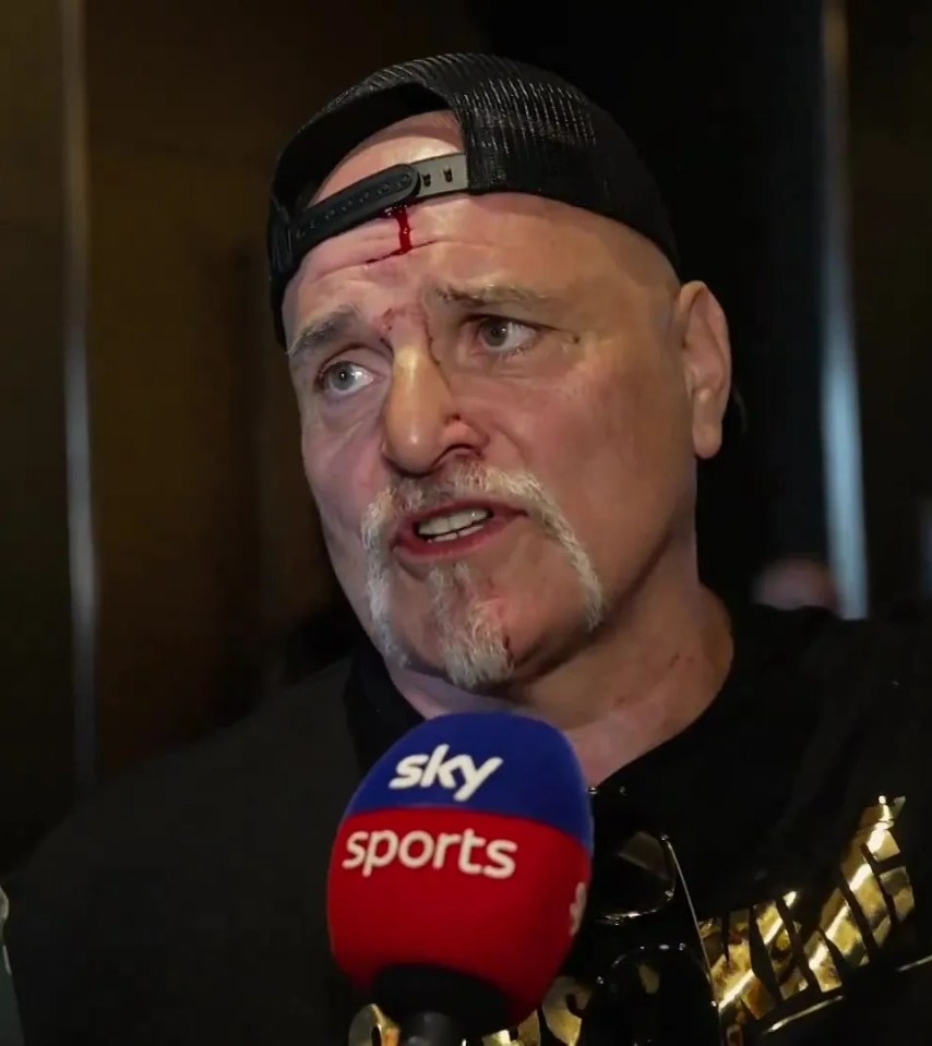 John Fury explained what happened in the lead-up to the headbutt