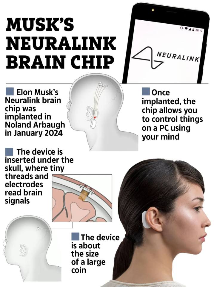 How Neuralink works