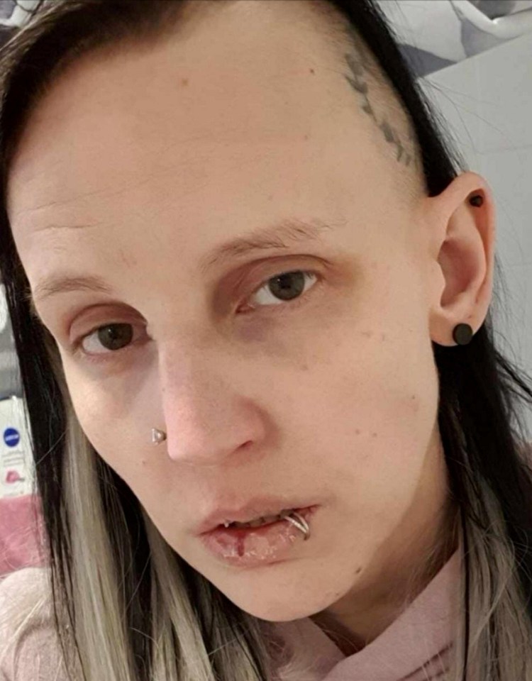 Amylee Pincott, who suffers from immune conditions and a brain injury, says she is vulnerable to damp and mould