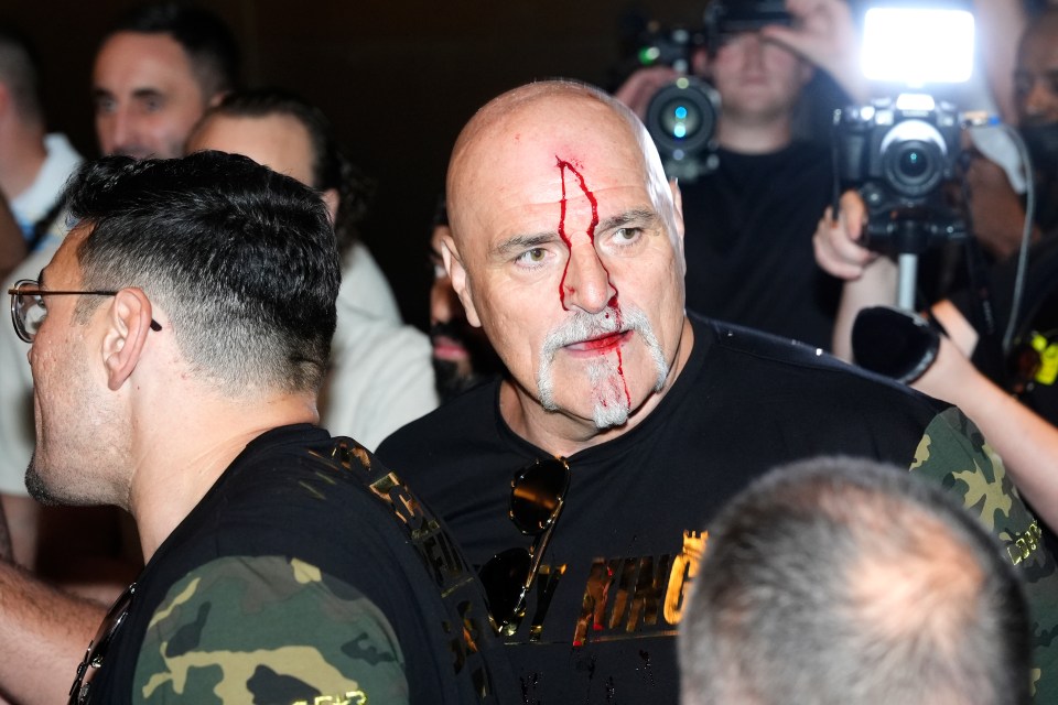 John Fury was covered in blood after a fracas