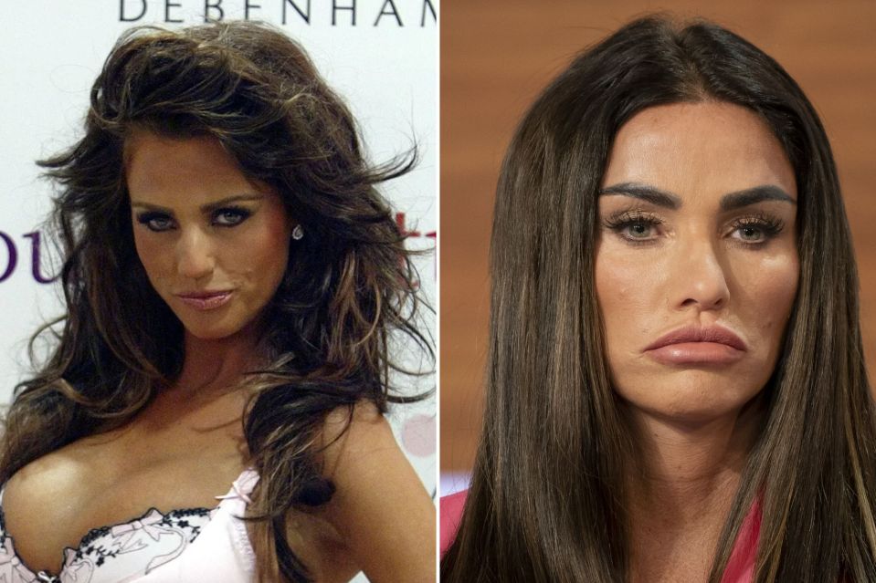 Katie Price is no stranger to cosmetic procedures