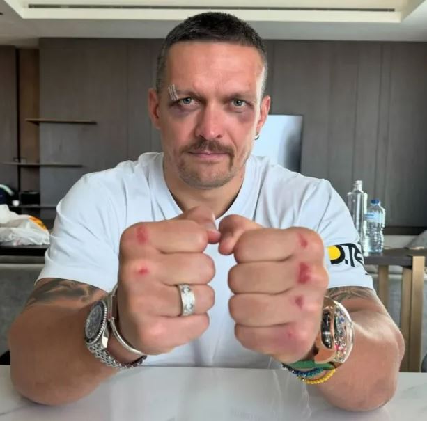 Usyk showing off his battle scars