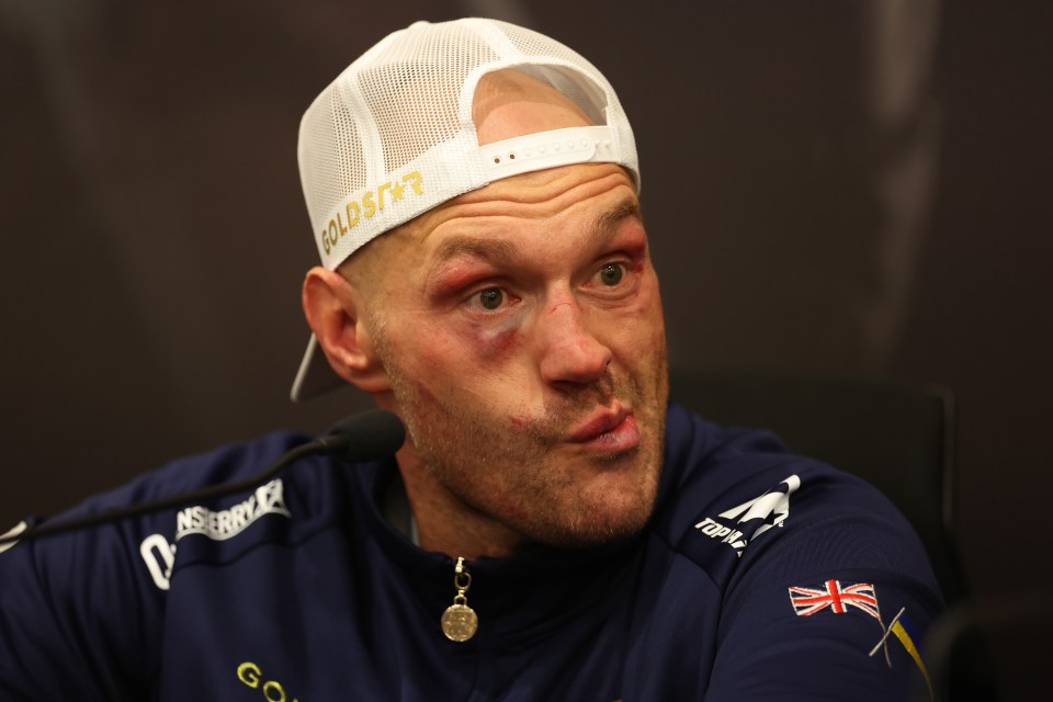 Tyson Fury lost his unbeaten record against the Ukrainian