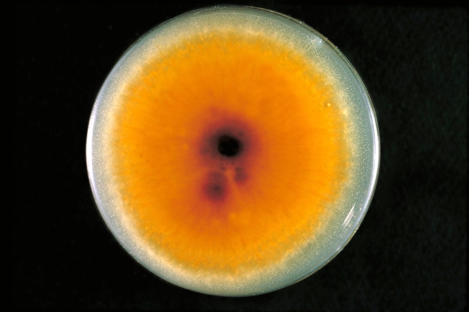 A plate culture containing the fungus Trichophyton mentagrophytes