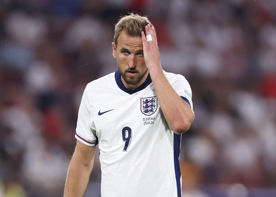 England were held to a 0-0 draw by Slovenia