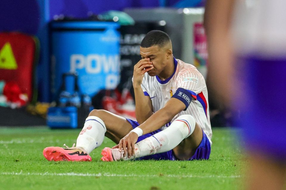 Mbappe suffered a broken nose in the Austria clash