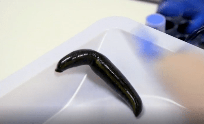 a close up of a leech in a plastic container