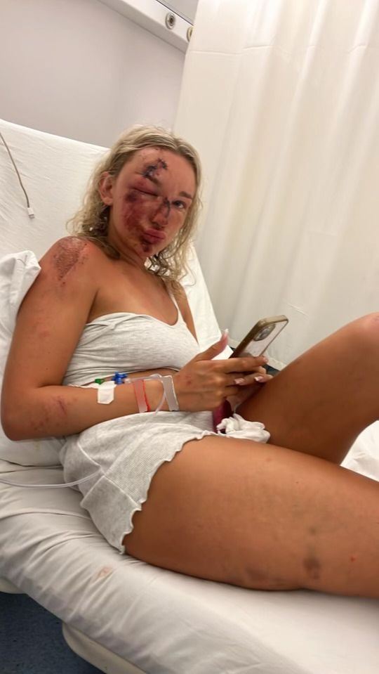 Holly on a hospital bed with a 'pool of blood' on her leg