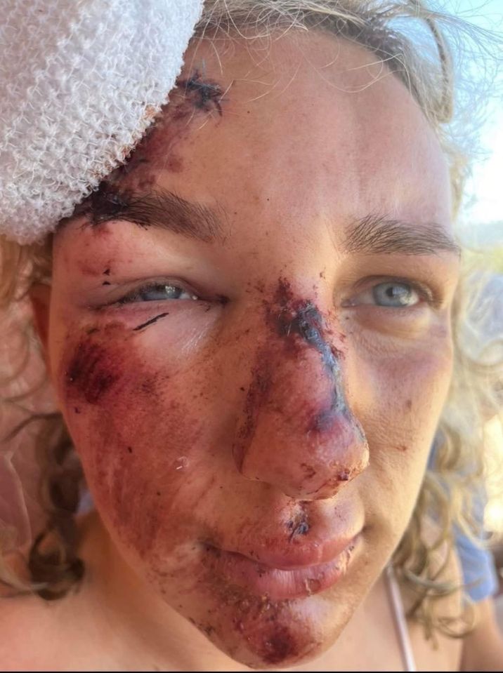 Dad David claims the brutal scarring has changed her life