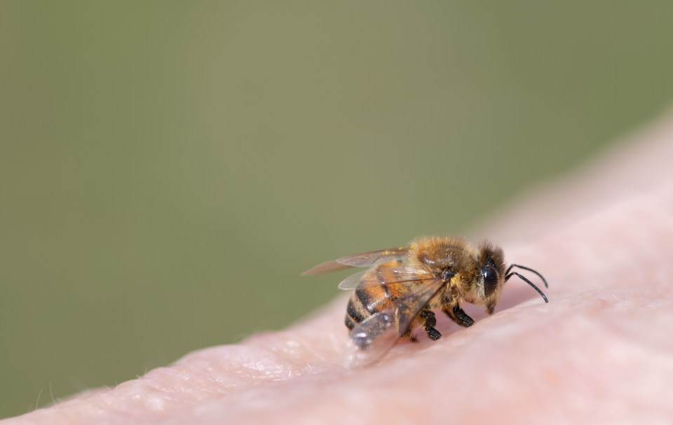 Bees will typically leave behind their stinger when they sting you - it's a good idea to remove it with tweezers