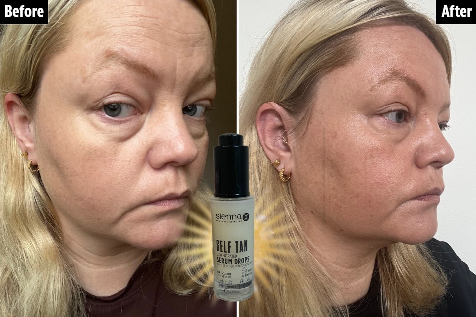 Sienna X Self tan drops (before and after).