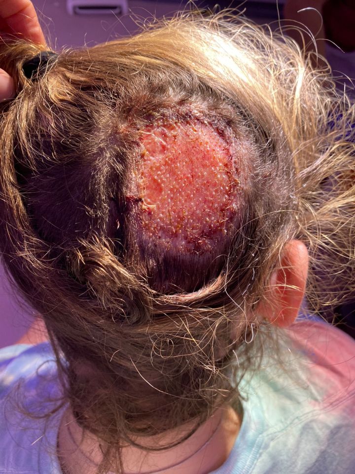 Sadly, Sammi believes things could have been different if the hairdresser had carried out a simple patch test