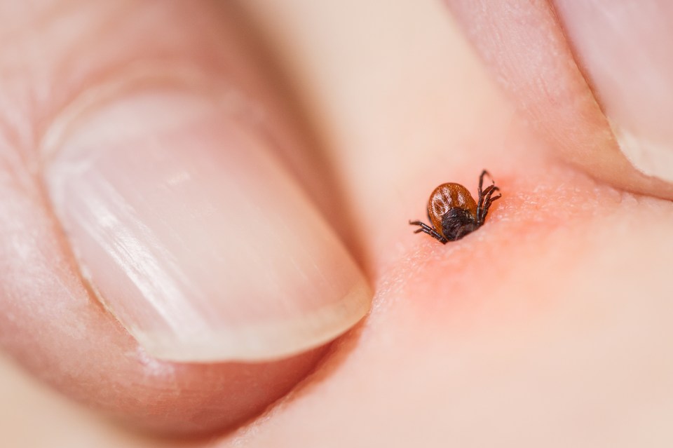 Tick bites aren't usually painful but the critters sometimes carry bacteria causing Lyme disease