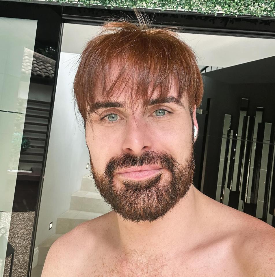 Rylan Clark showed off his natural hair colour