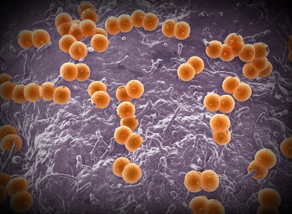 Meningococcal disease is caused by the bacterium Neisseria meningitidis and can result in meningitis and septicaemia