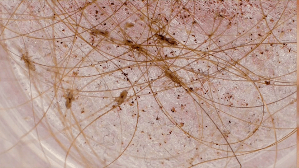 a close up of a pile of hair with lice on it