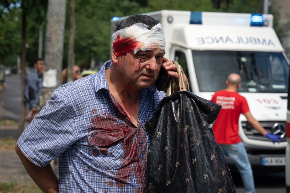 A man with blood pouring from his head after he was caught up in one of the missile attacks